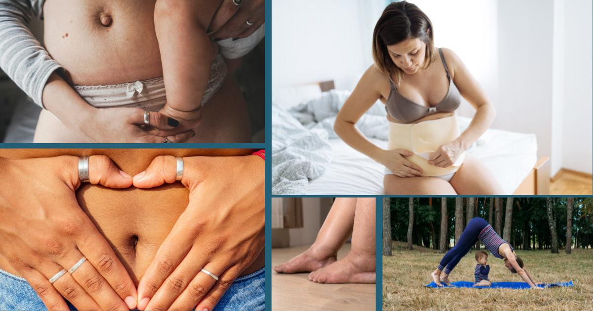 Natural Remedies to Ease Postpartum Swelling: 5 Gentle Solutions